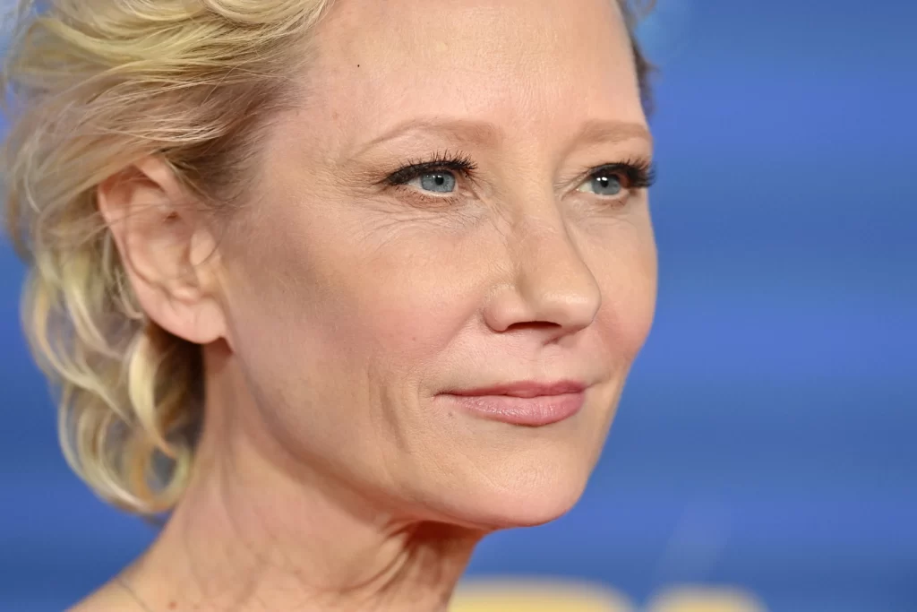 Anne Heche 102 gettyimages 1024x683 1
